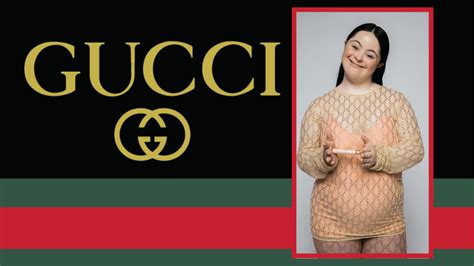 down syndrome holding gucci slides|Gucci down syndrome.